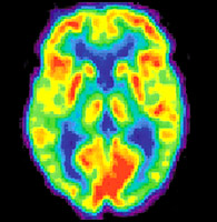 brain imaging stamp